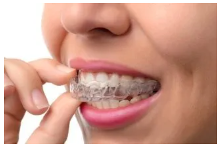 Trattamento ortodontico Invisalign